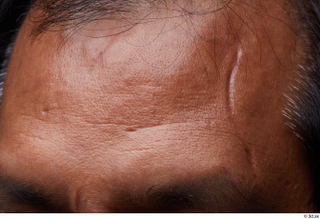 HD Face Skin Enoch Gorat eyebrow face forehead scar skin…